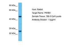 PLEKHB1/PHR1 Rabbit anti-Human, Polyclonal, Novus Biologicals 0.1 mL | Buy Online | Novus Biologicals | Fisher Scientific